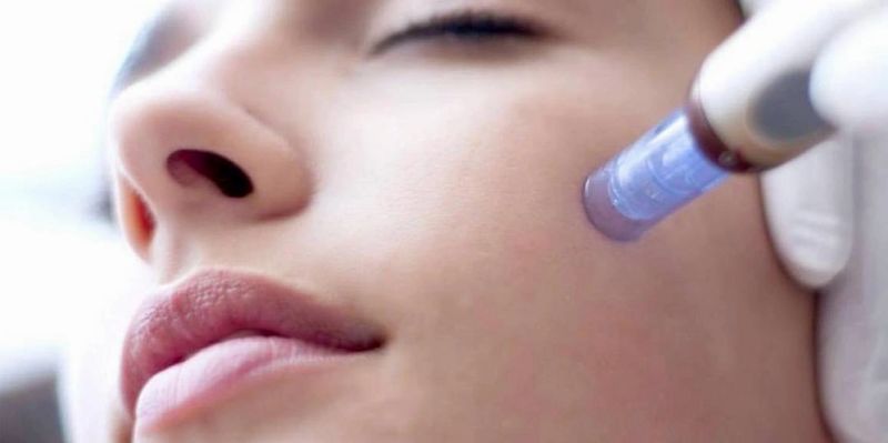 Microneedling (Derma Pen)